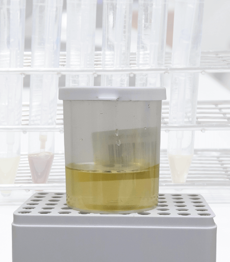 Внешний вид мочи