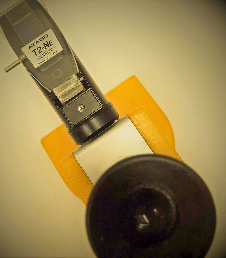 Удельный вес мочи (относительная плотность)